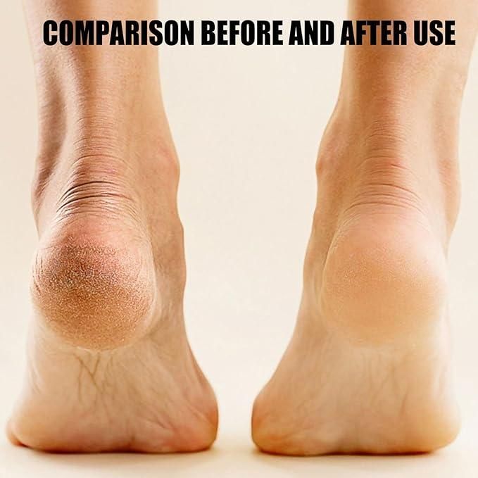 Electronic Pedicure Tool - Sxndhu Hub